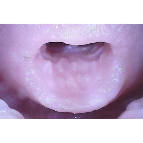 Tomax - Dolphin! Soft Masturbator Onahole (Beige) TM1056 CherryAffairs